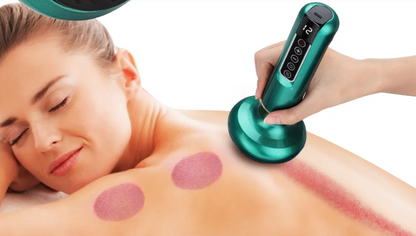 Therapy Flow Pro Cupping Device